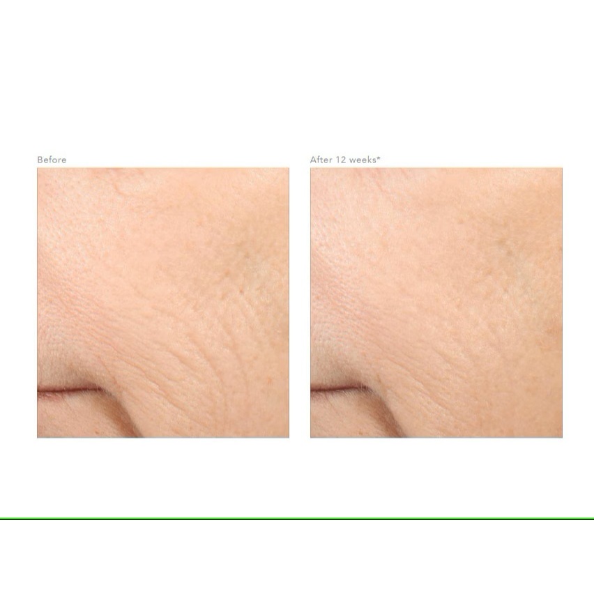 0.5% REVISION RETINOL COMPLETE