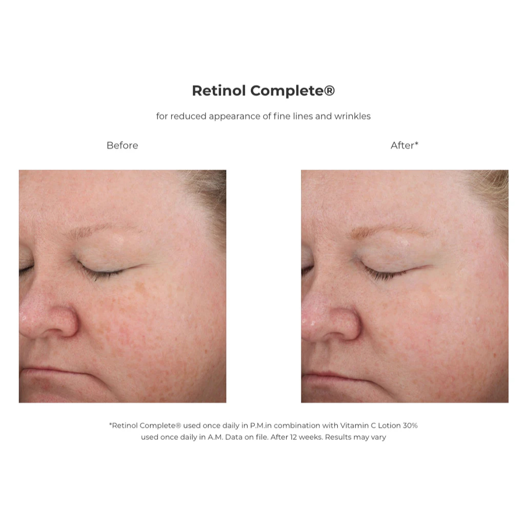 0.5% REVISION RETINOL COMPLETE