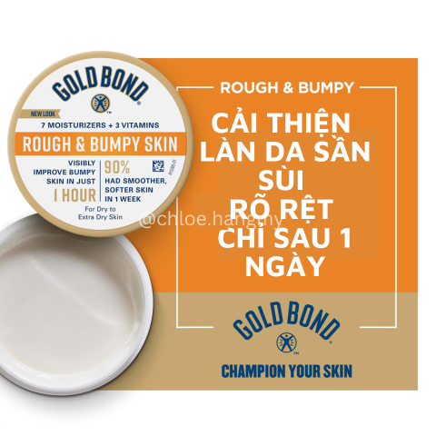 Kem dưỡng da Gold Bond Rough and Bumpy Cream làm mịn sáng da 226g