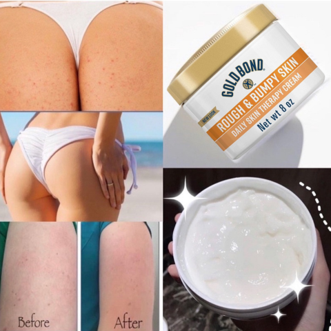 Kem dưỡng da Gold Bond Rough and Bumpy Cream làm mịn sáng da 226g