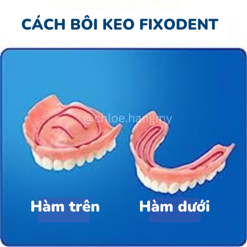 Keo dán hàm răng giả Fixodent Orginal 68g Mỹ