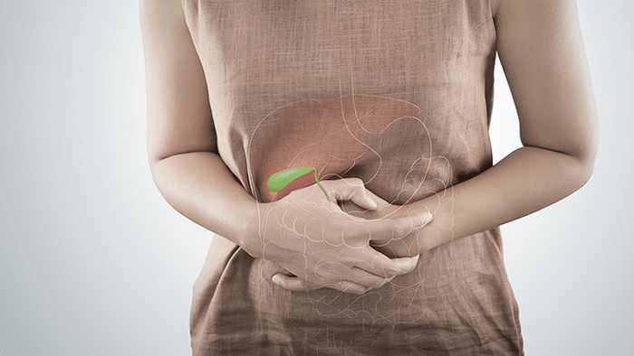 Làm thế nào để giảm đau bụng, khó tiêu do sỏi mật 9,5mm?