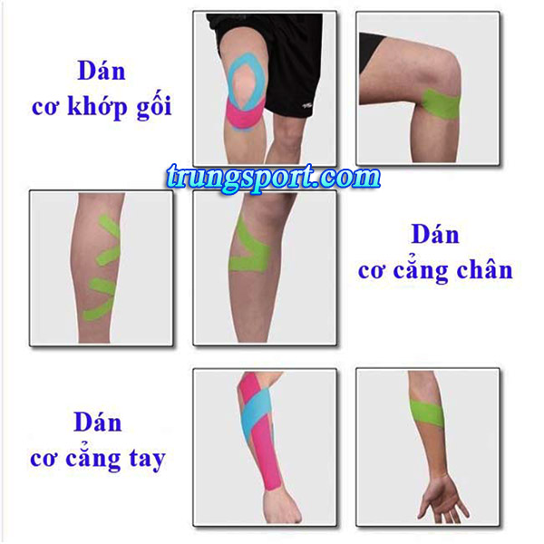 Băng Dán Cơ Thể Thao - Giảm Căng Cơ, Phục Hồi Cơ Bắp Vượt Trội