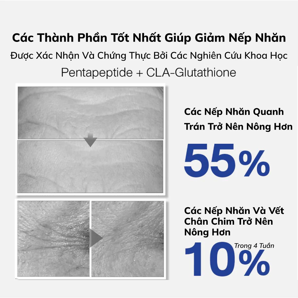 Serum làm mờ nếp nhăn, trắng da Dr.PONG Retinal-X Timeless Anti-Aging 15ml