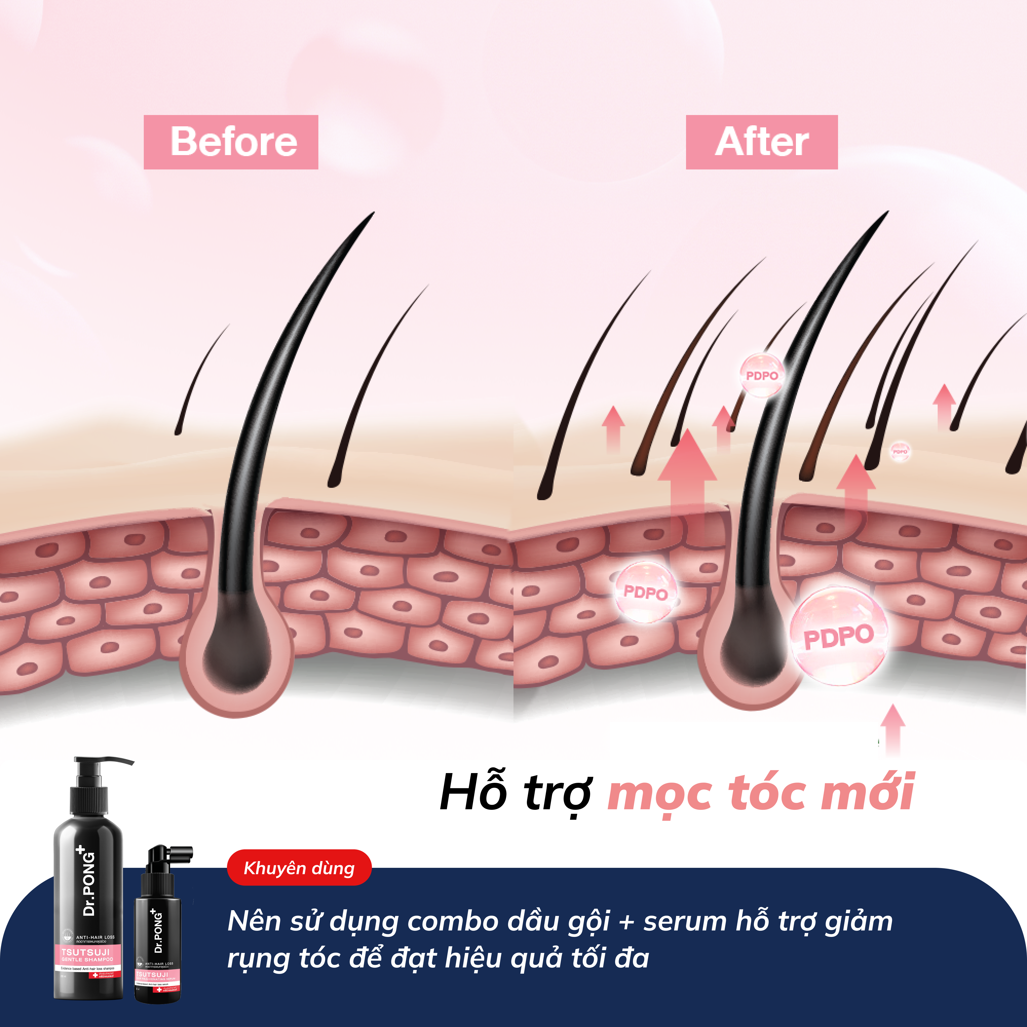 Serum giảm rụng tóc, kích thích chân tóc phát triển, chăm sóc da đầu Dr.PONG Tsutsuji Hair Rejuvenating - anti- hairloss