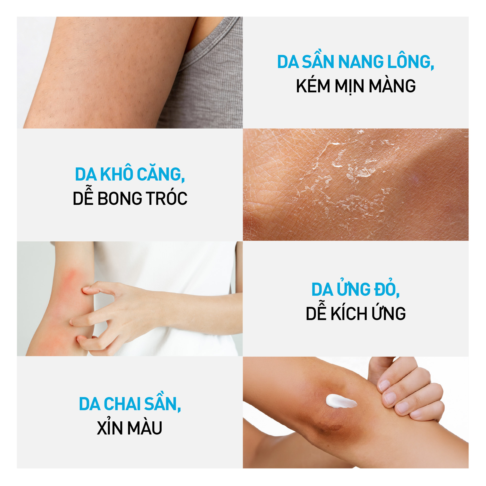 Kem dưỡng hỗ trợ giảm thô ráp, nứt nẻ và dưỡng ẩm cho da Dr.PONG U9.9 RENEWAL CREAM