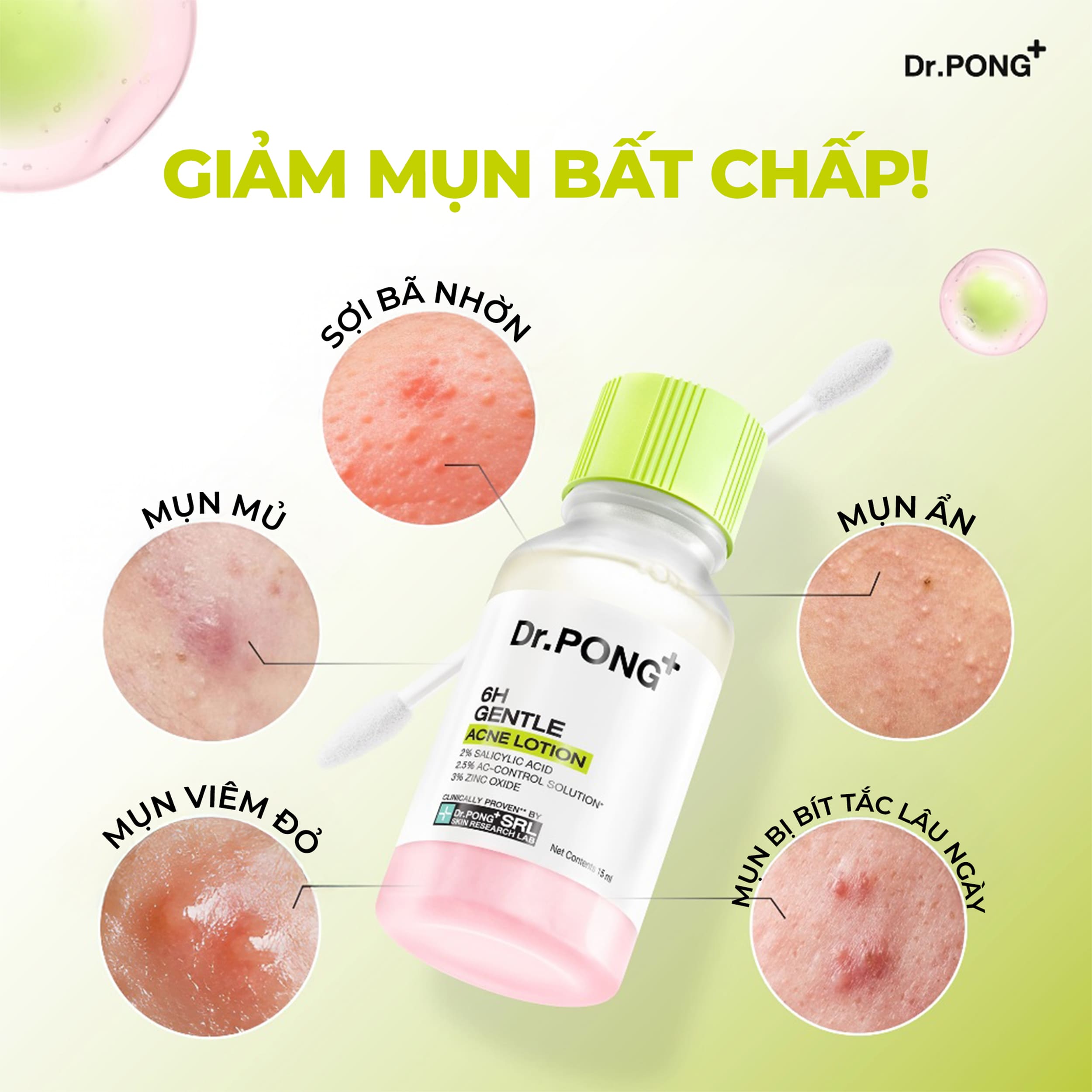 Chấm mụn 2 lớp hỗ trợ gom cồi, giảm mụn Dr.PONG 6H Gentle Acne Lotion