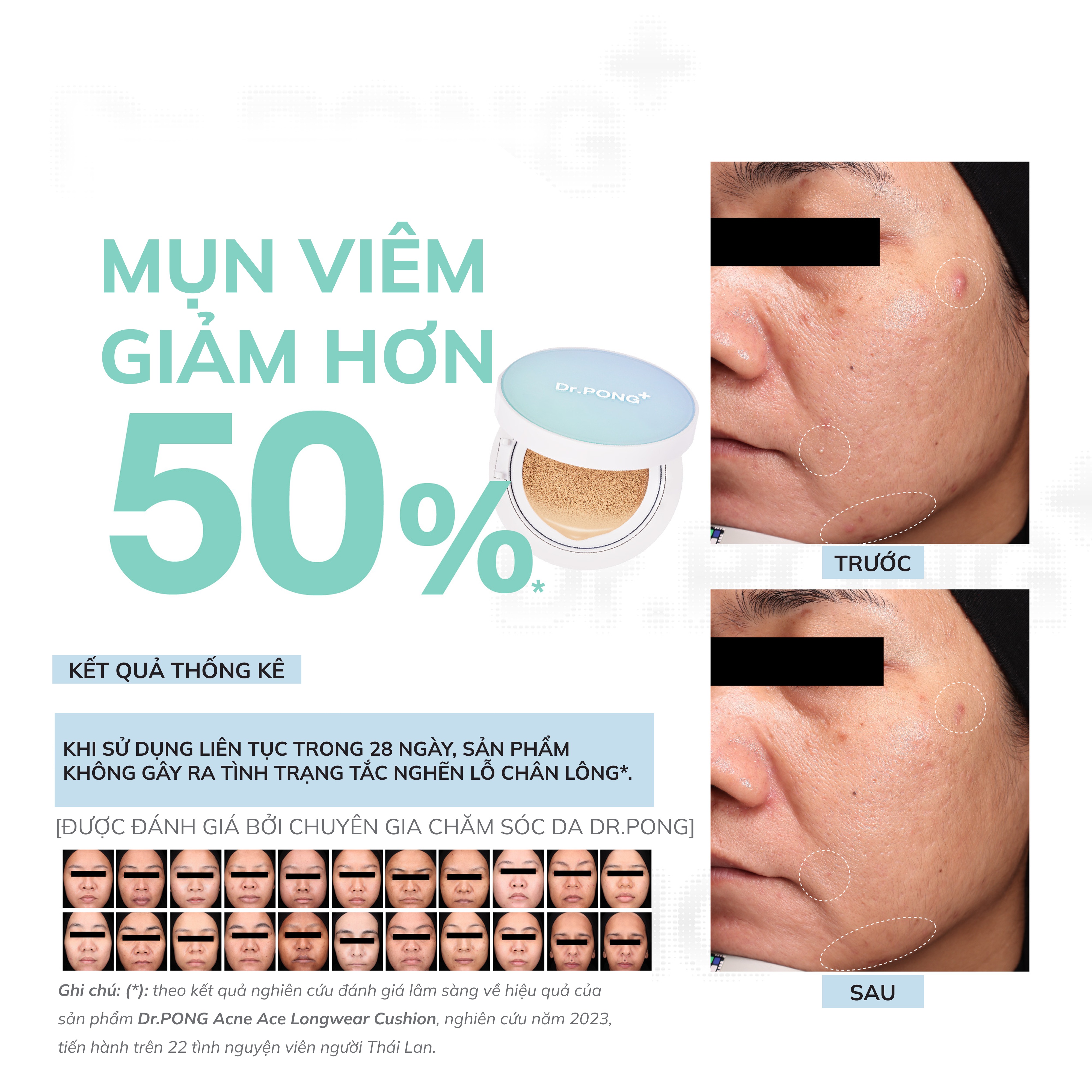 Phấn nước dành cho da dầu mụn Dr.PONG Acne Ace Longwear Cushion 15g