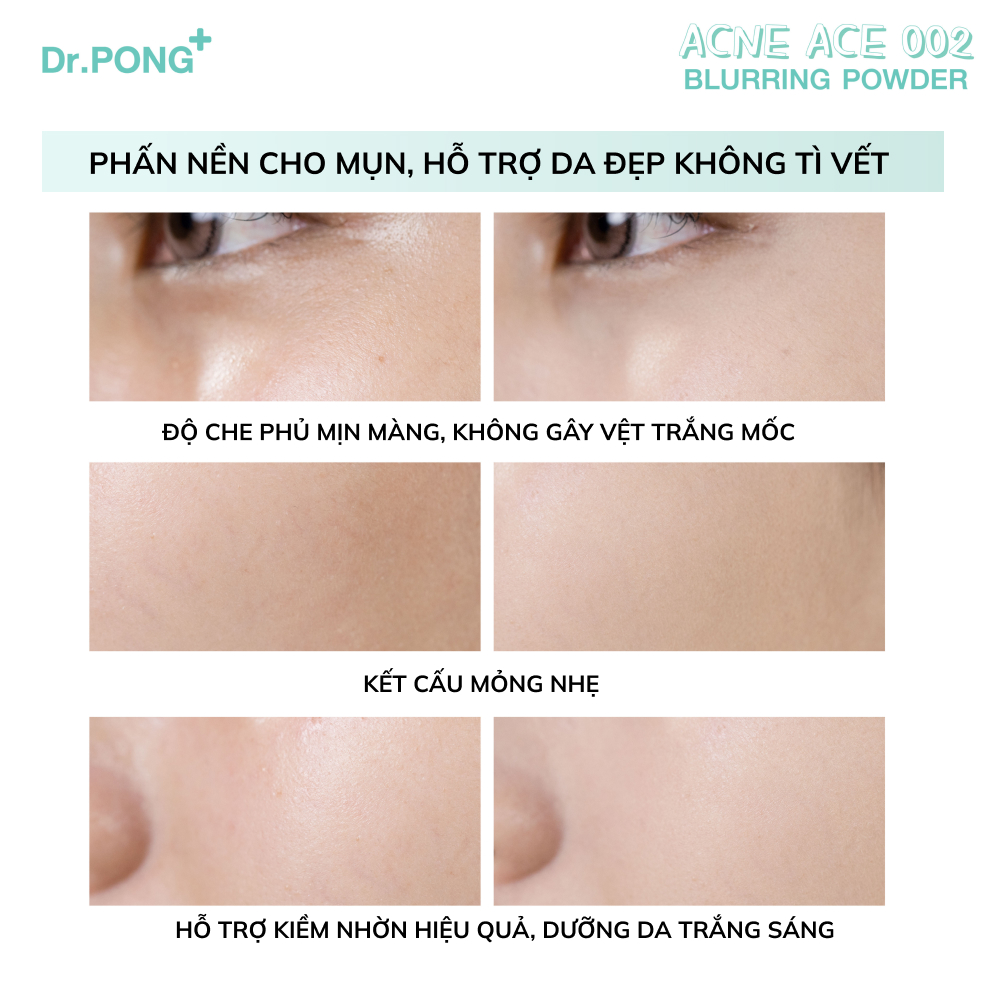 Phấn nền hỗ trợ kiềm dầu dành cho da mụn Dr.PONG Acne Ace 002 Blurring Powder 9g