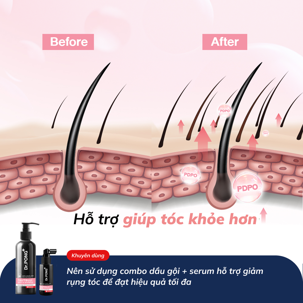Serum hỗ trợ giảm rụng tóc Dr.PONG Tsutsuji Hair Rejuvenating Serum
