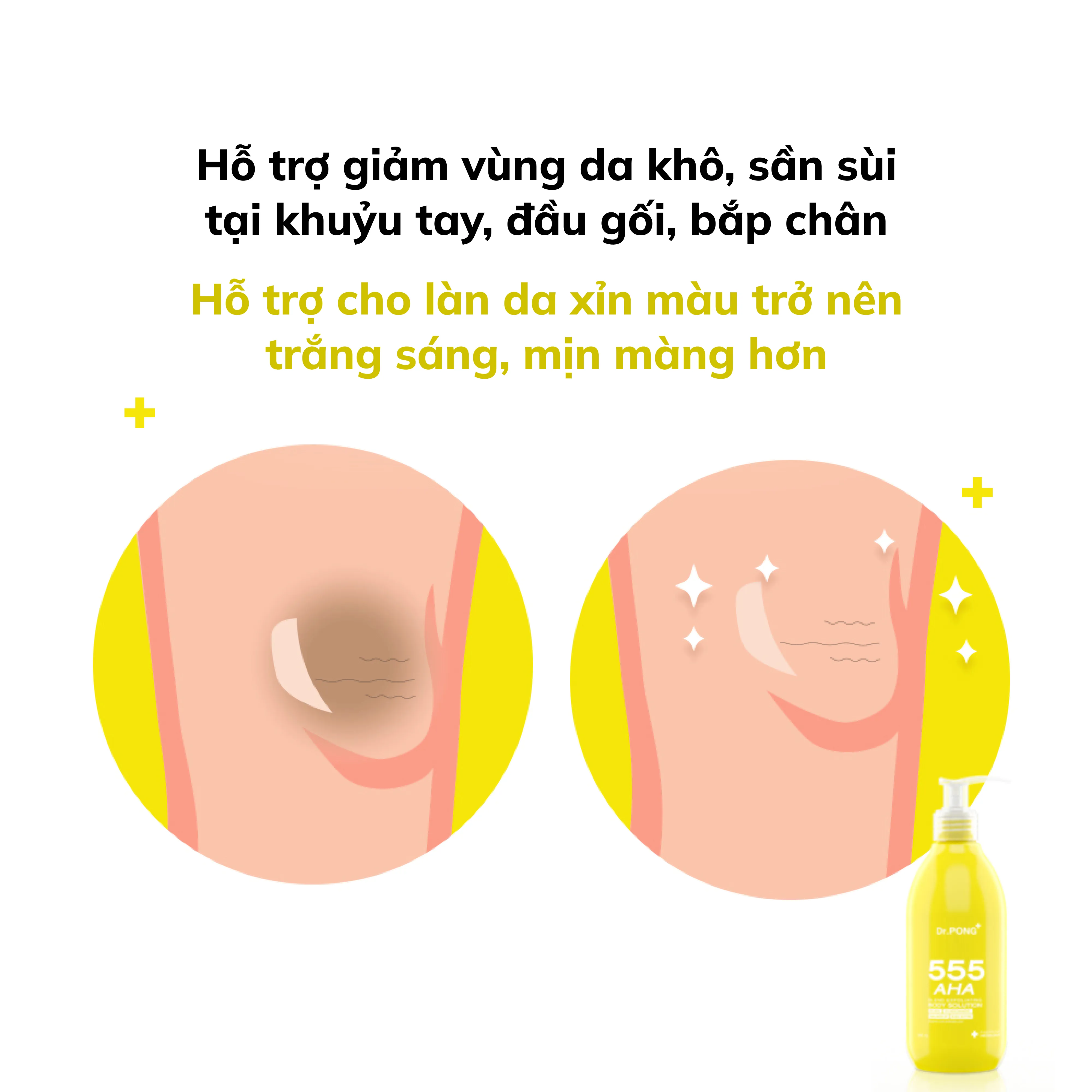 Sữa tẩy tế bào da chết, dưỡng ẩm và trắng da toàn thân Dr.PONG 555 AHA Blend Exfoliating 295ml