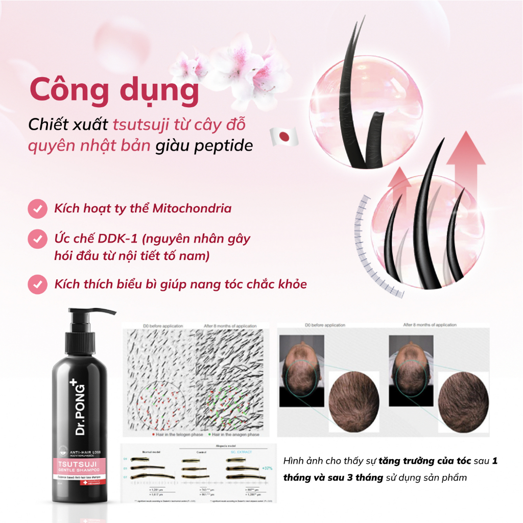 Dầu gội giảm rụng tóc, hỗ trợ mọc tóc Dr.PONG Tsutsuji Gentle 200ml