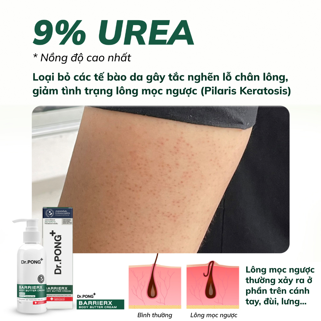 Kem dưỡng thể Dr.PONG BarrierX body butter cream 100g