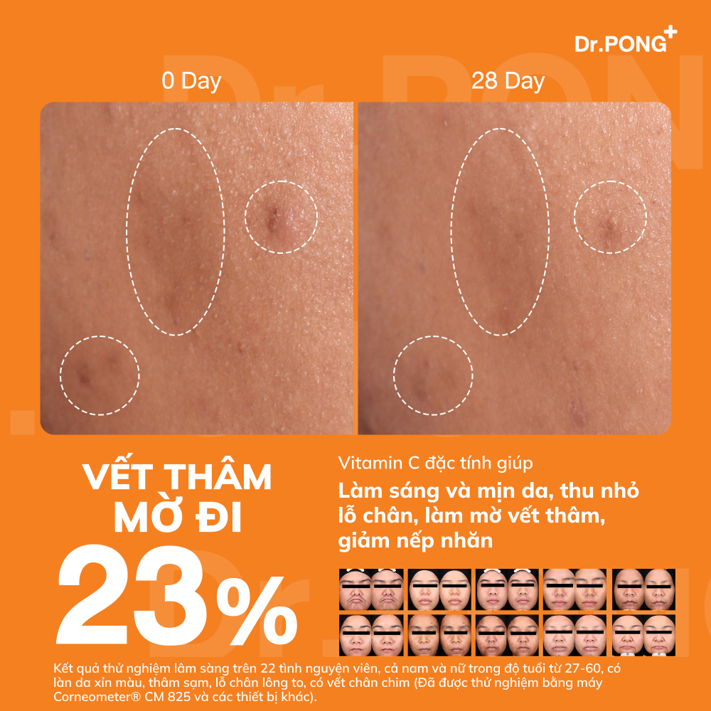 Serum Vitamin C dưỡng trắng, mờ thâm,thu nhỏ lỗ chân lông và chống oxy hóa Dr.Pong 15c Antioxidant Vitamin C Shake Shake