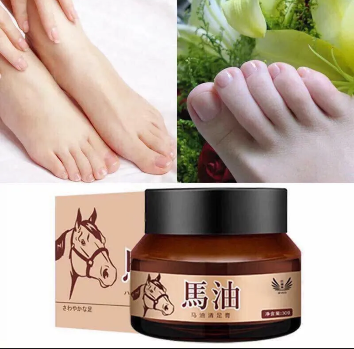 Kem cao ngựa, trị nứt nẻ toàn thân, tay chân, gót chân