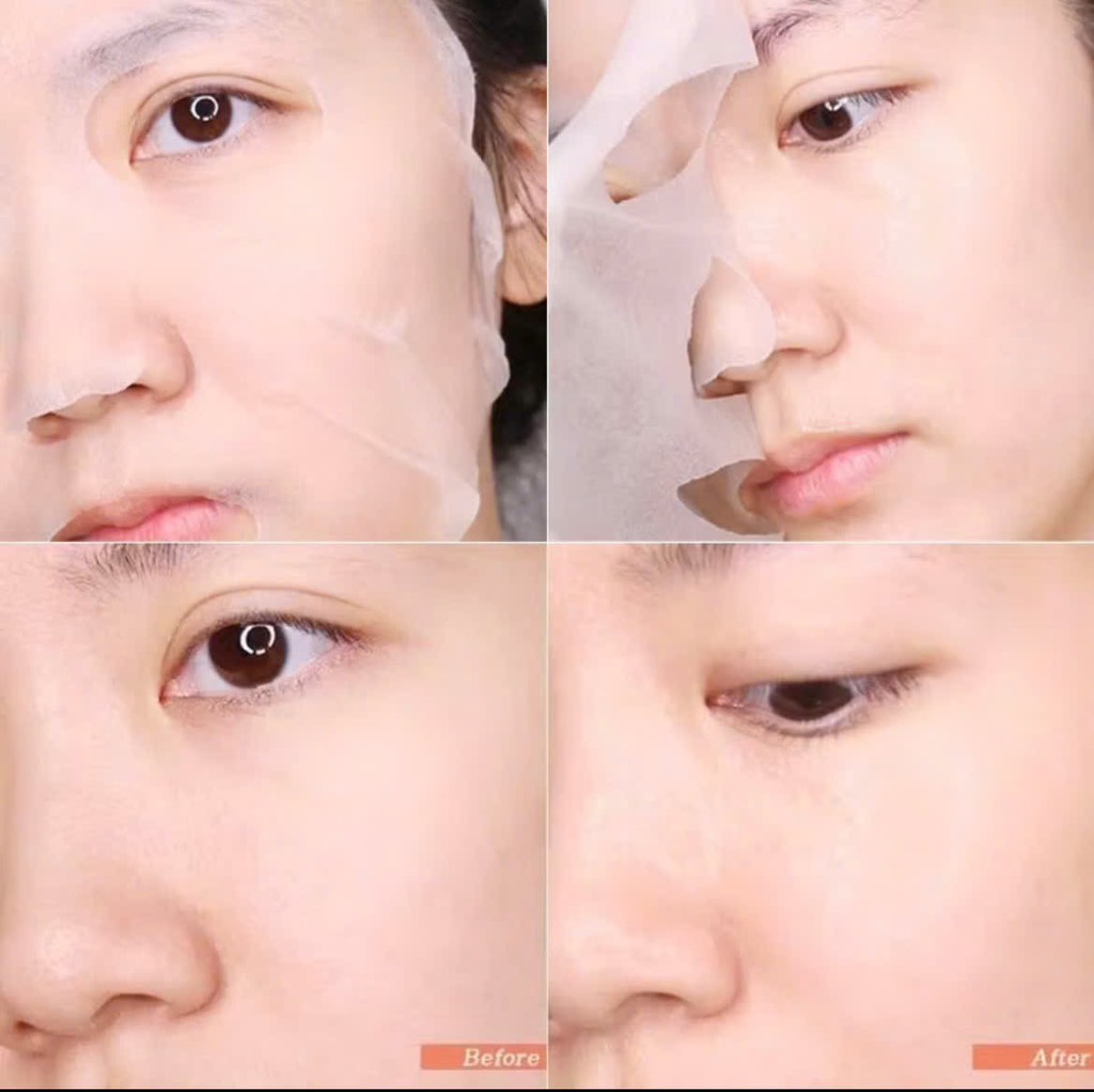 Mặt Nạ Some By Mi