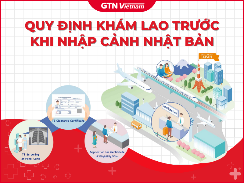 QUY ĐỊNH SÀNG LỌC BỆNH LAO TRƯỚC KHI NHẬP CẢNH NHẬT BẢN MỚI NHẤT