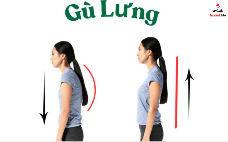Tập luyện thể thao đều đặn giúp cải thiện tư thế và tránh gù lưng
