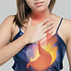 Trào ngược dạ dày