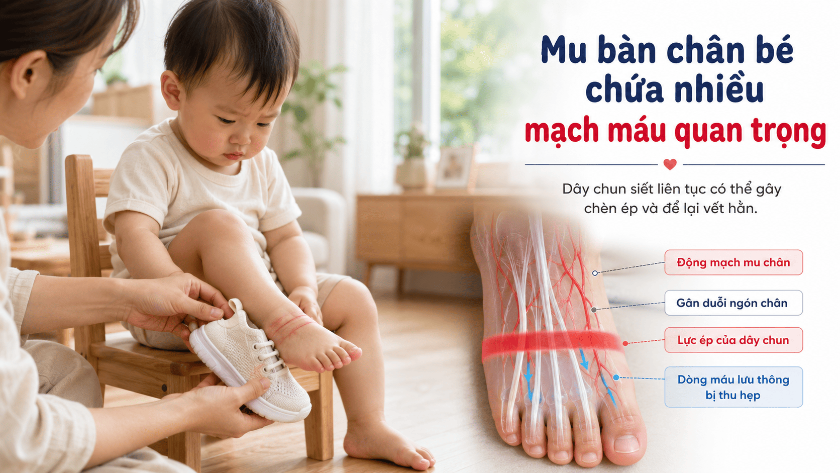 Nguy cơ từ dây giày chun co giãn: Siết đau mu chân, làm hỏng dáng đi!