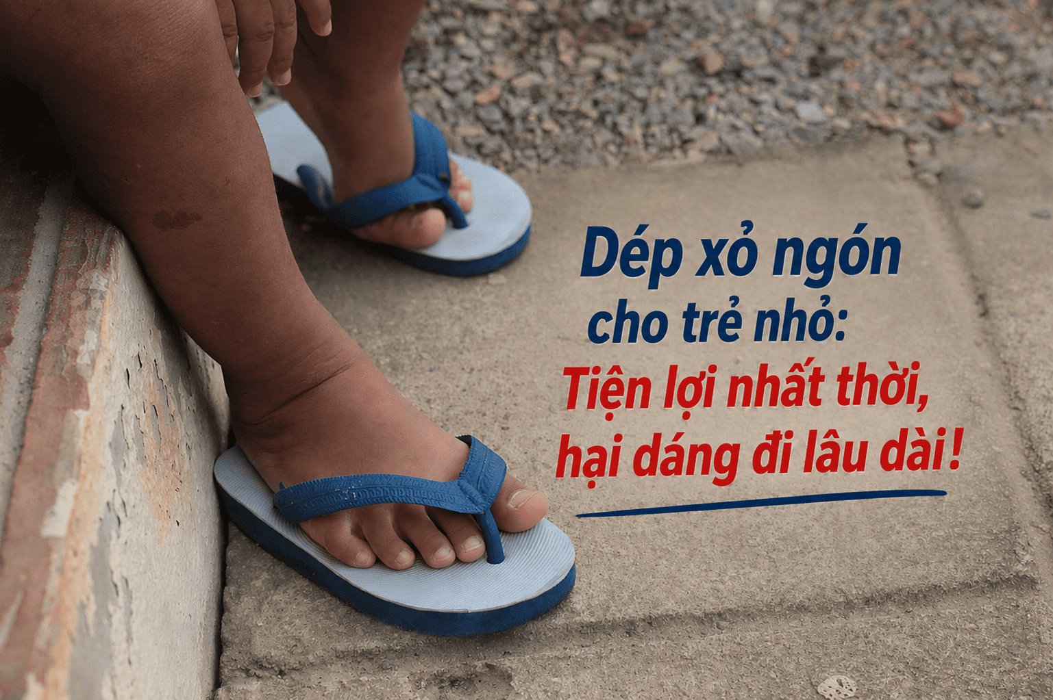 Dép xỏ ngón cho trẻ nhỏ: Tiện lợi nhất thời, hại dáng đi lâu dài!