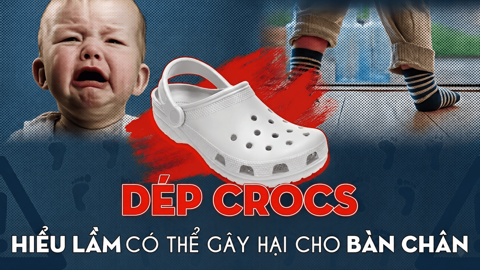 Cho con đi dép sục nhựa cả ngày: Hiểm họa biến dạng chân vĩnh viễn