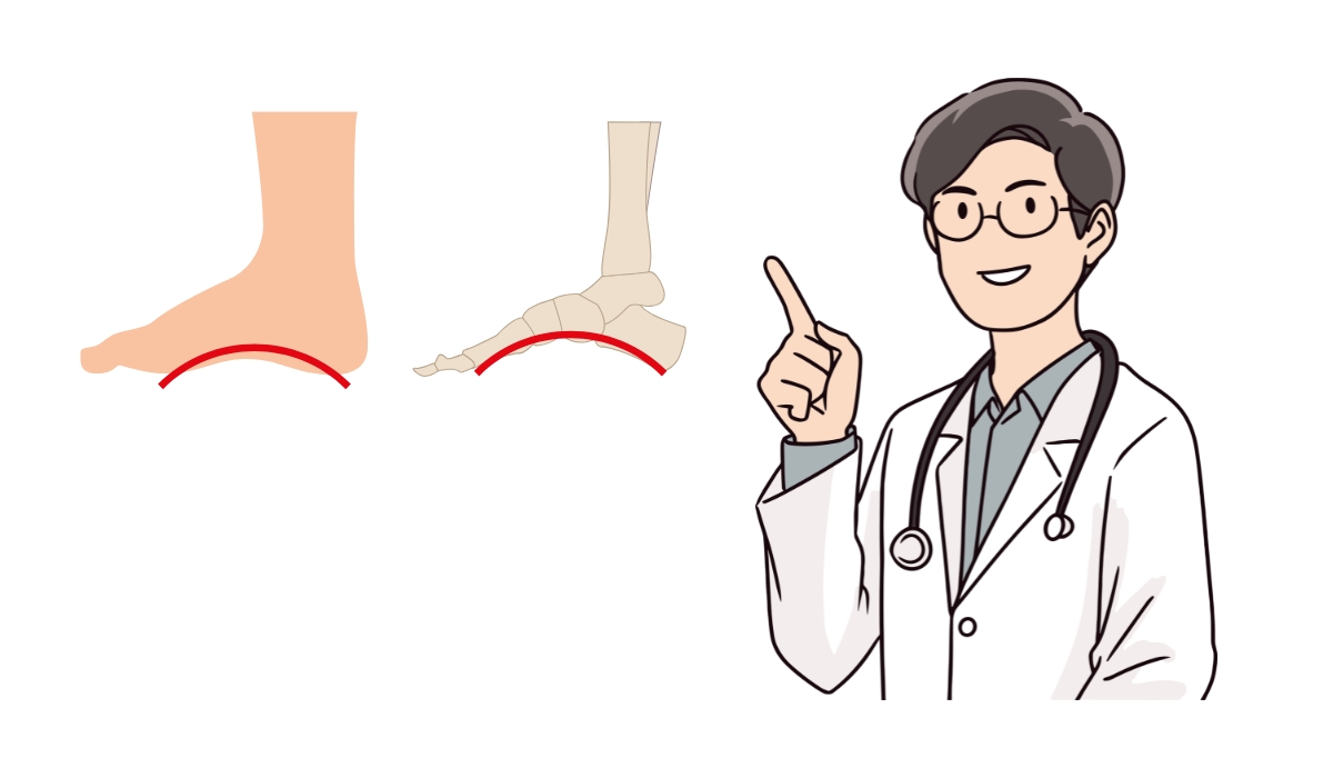 VAI TRÒ CỦA LÓT GIÀY CHỈNH HÌNH (ORTHOTICS) – KHI NÀO NÊN DÙNG VÀ CÁCH CHỌN ĐÚNG CHUẨN