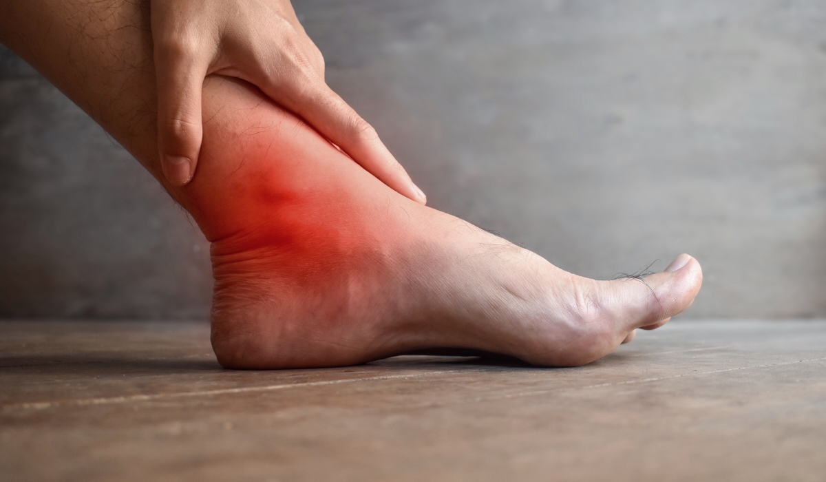 BÀN CHÂN VÒM CAO ĐANG GÂY TỔN THƯƠNG KHỚP VĨNH VIỄN
