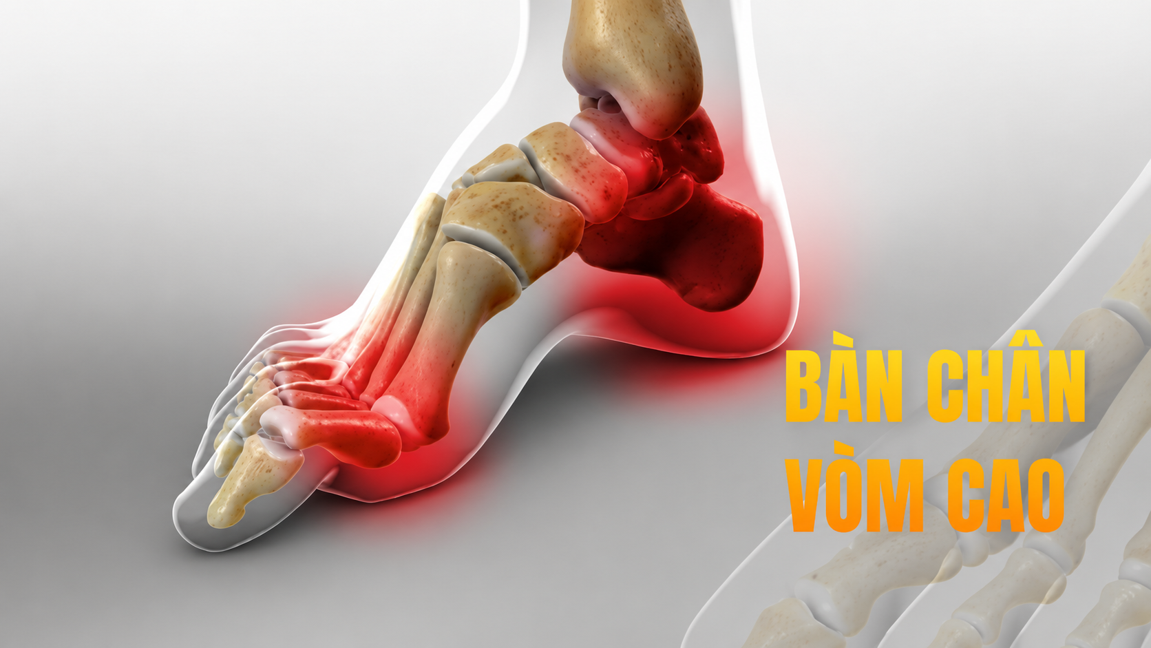 Vì sao giày thể thao có đệm vòm quá cao dễ làm hỏng bàn chân của trẻ?