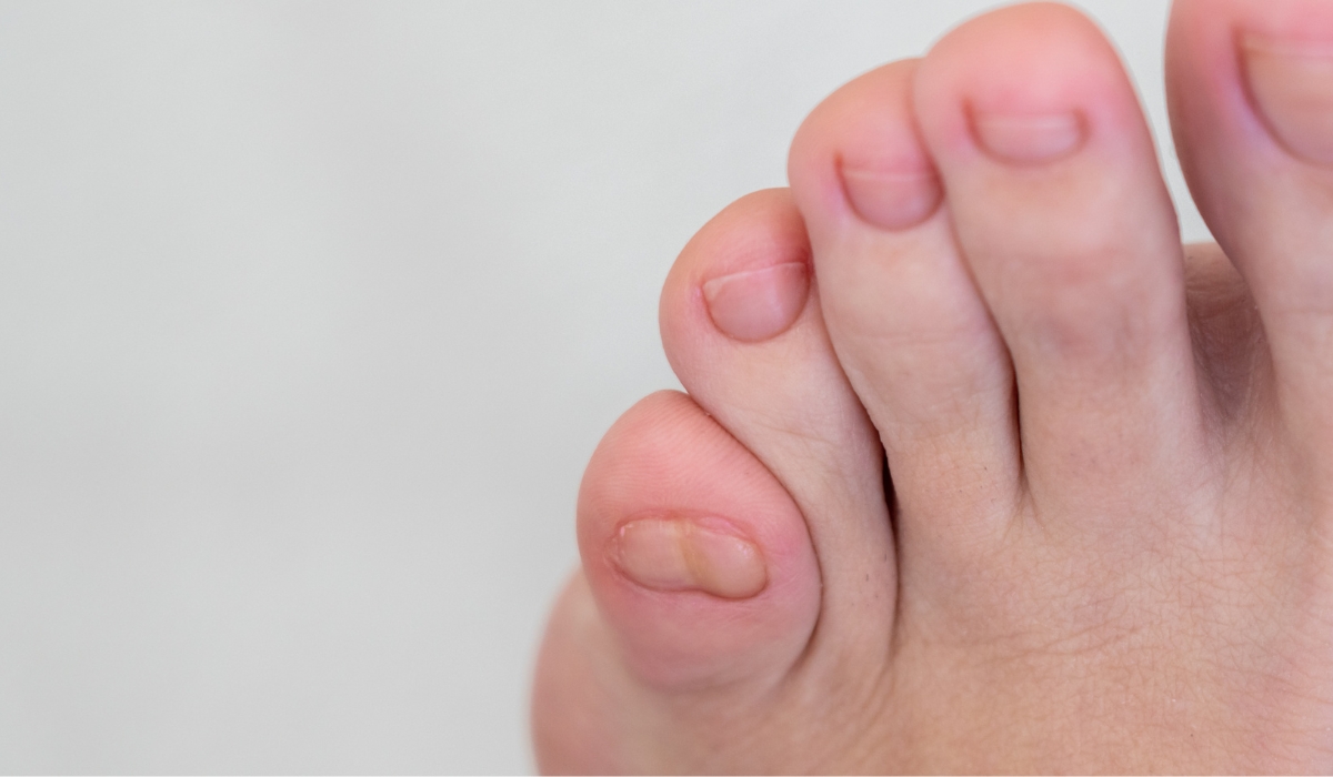 NGÓN CHÂN CON BẠN BỊ 