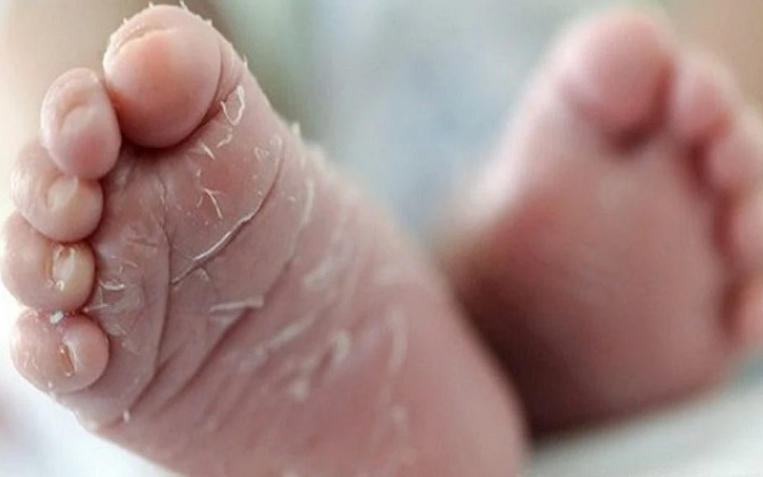 Da chân con bị lột, bong tróc: Tác hại từ đôi dép nhựa đúc cứng ngắc!
