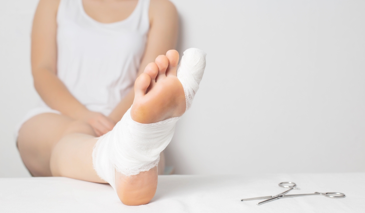 Điều trị ngón chân xếp chồng lên nhau bằng cách sử dụng băng keo y tế