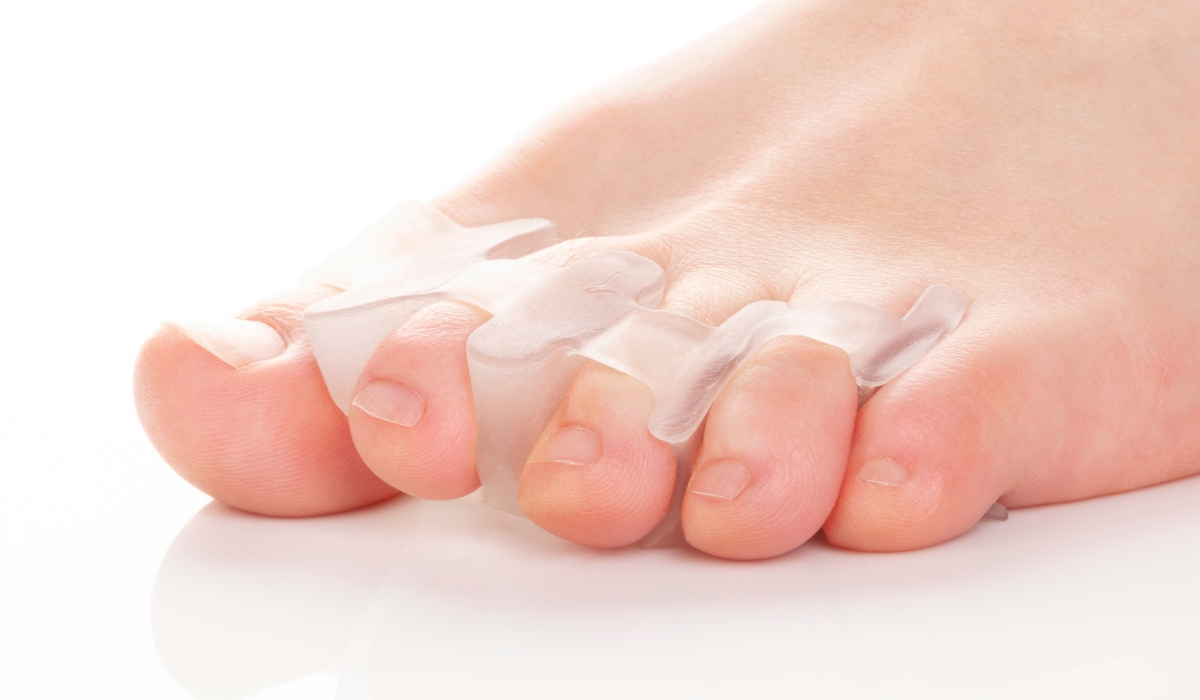 Điều trị ngón chân xếp chồng bằng nẹp ngón chân Silicone