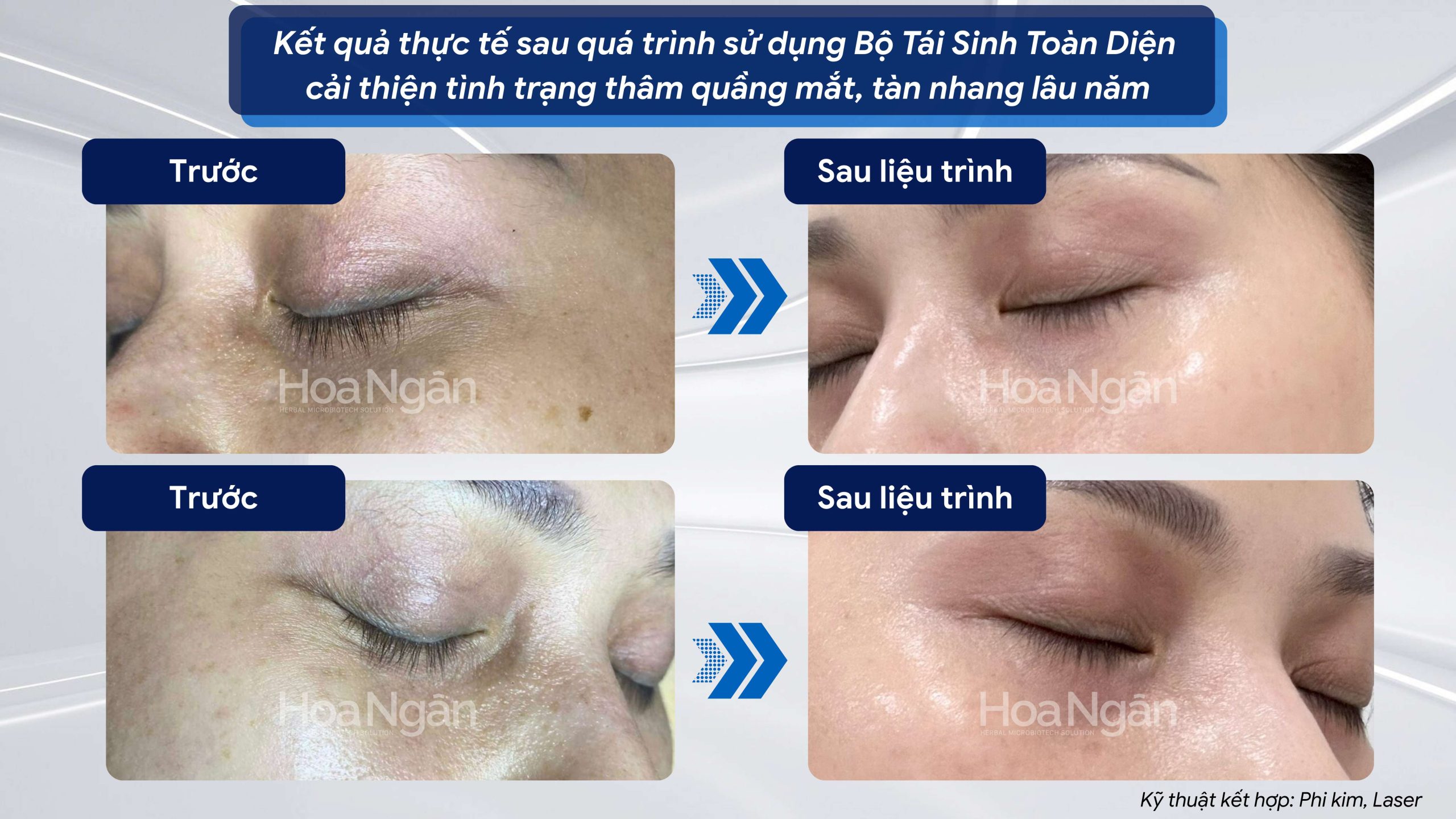 Hiệu quả từ khách hàng sử dụng Mỹ phẩm vi sinh Hoa Ngân