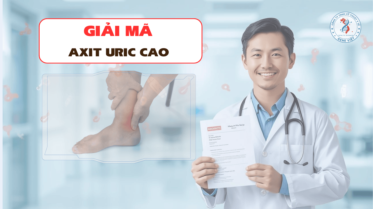 Axit uric cao có phải bị gout không?