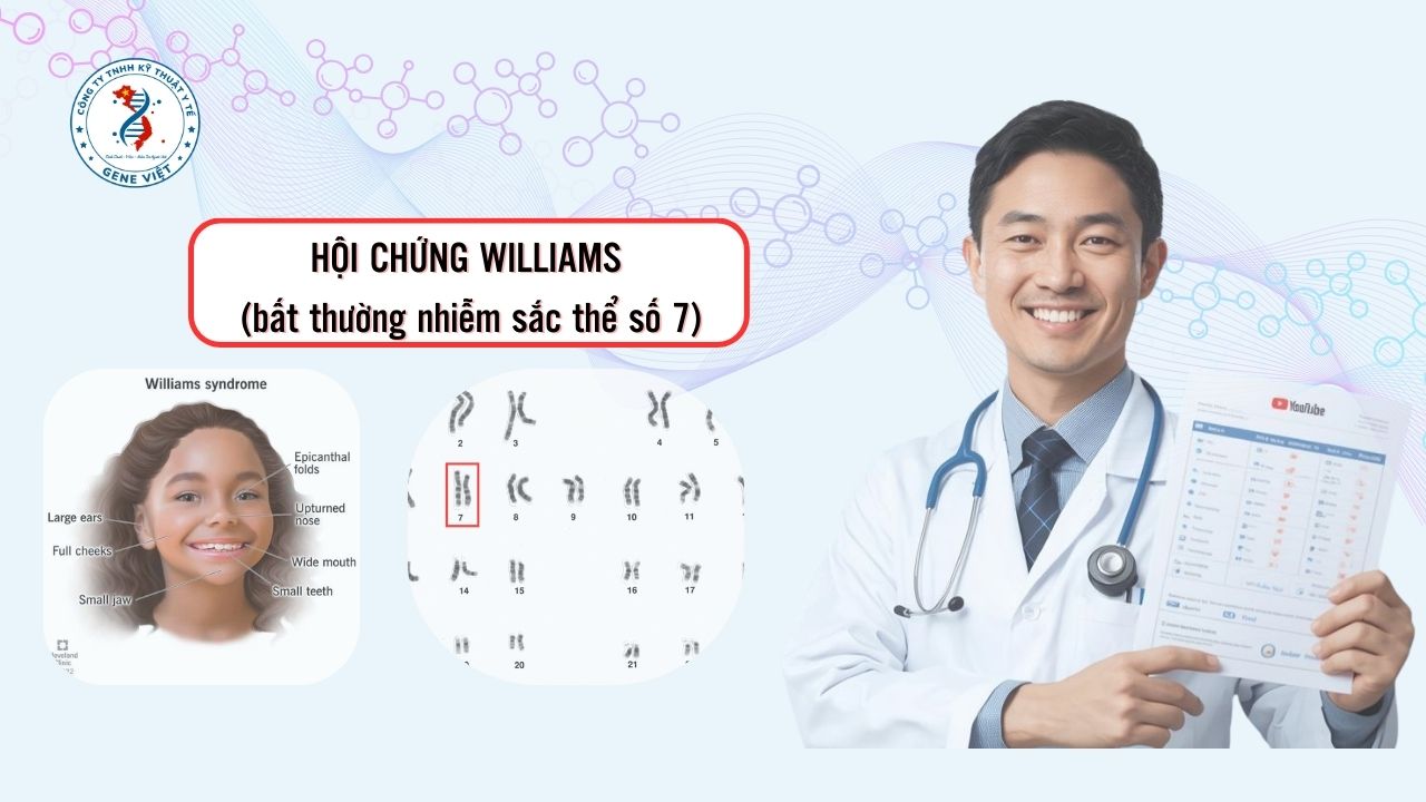 Hội chứng Williams (bất thường nhiễm sắc thể số 7)