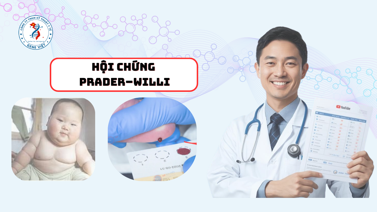 Hội chứng Prader–Willi là gì?
