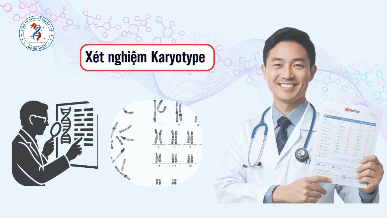 Tổng Quan Xét Nghiệm Karyotype