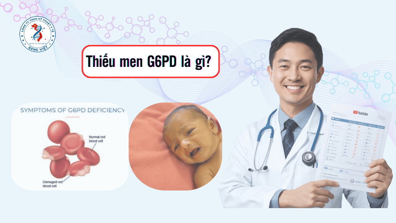 Thiếu Men G6PD Là Gì? Dấu Hiệu Và Sàng Lọc Sớm Cho Trẻ