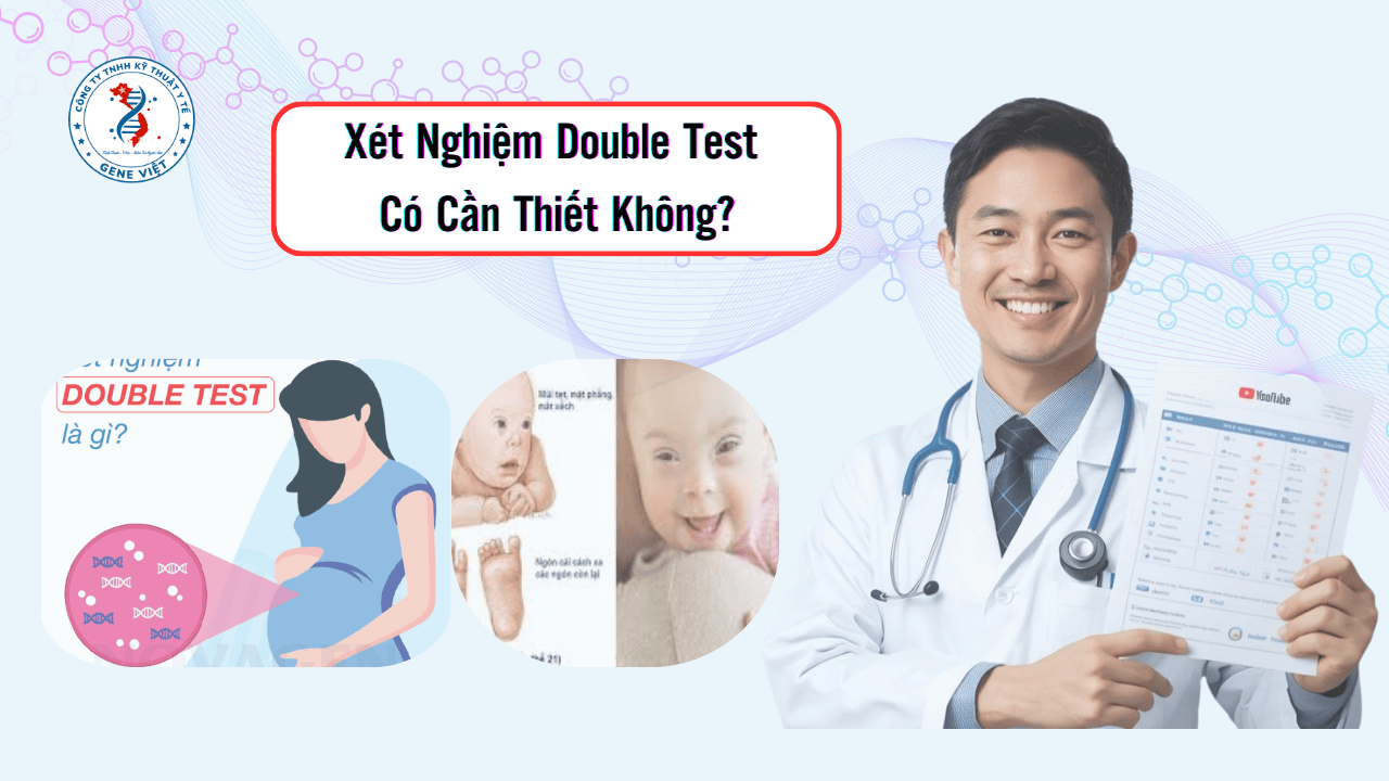 Xét Nghiệm Double Test Có Cần Thiết Không?