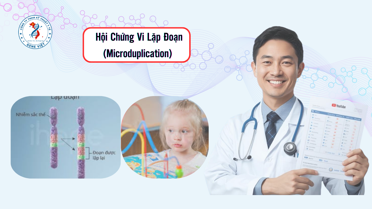 Hội Chứng Vi Lặp Đoạn (Microduplication) Là Gì?