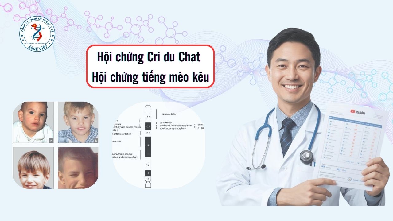 Hội chứng Cri du Chat (hội chứng tiếng mèo kêu)