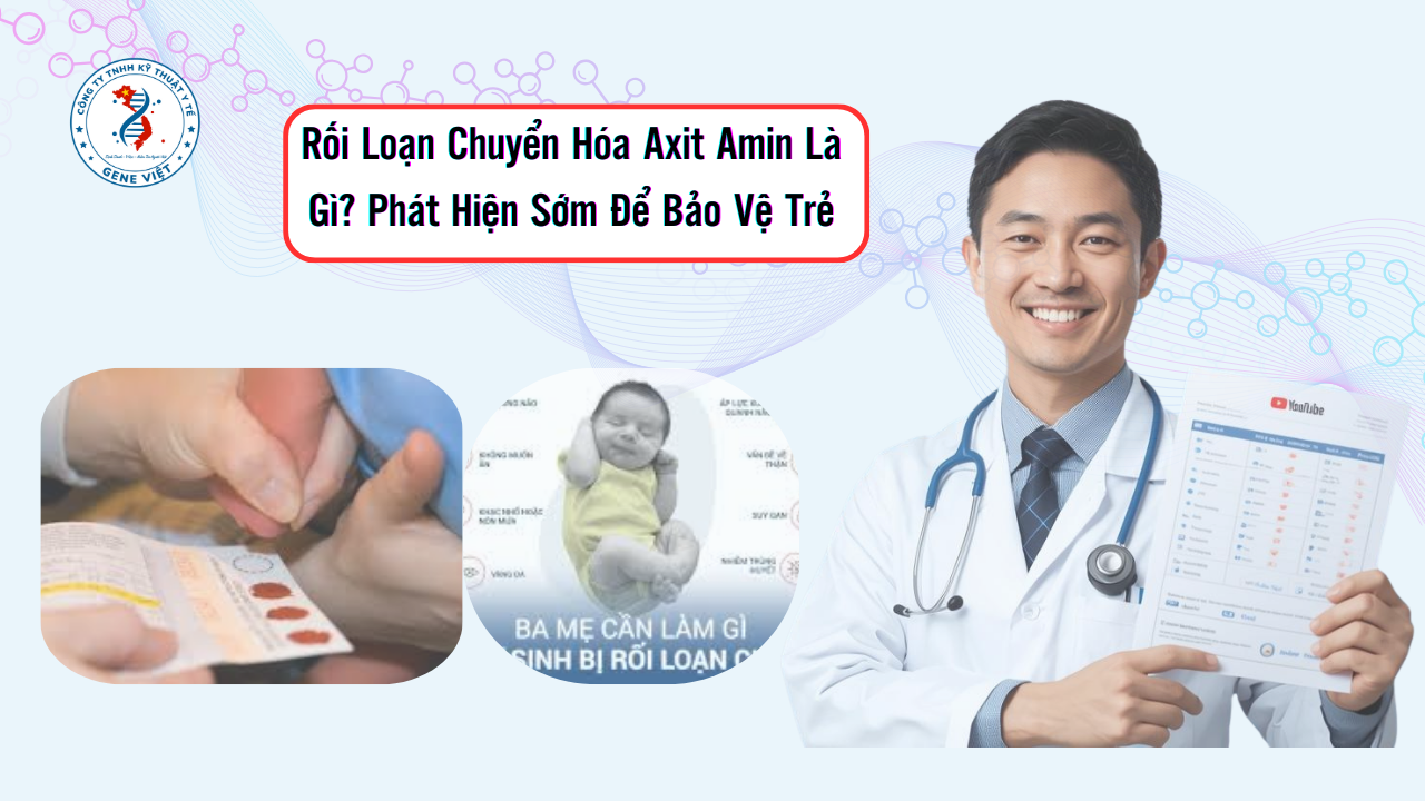 Rối Loạn Chuyển Hóa Axit Amin Là Gì? Phát Hiện Sớm Để Bảo Vệ Trẻ