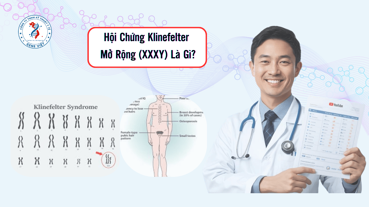 Hội Chứng Klinefelter Mở Rộng (XXXY) Là Gì?