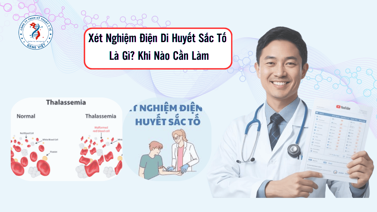 Xét Nghiệm Điện Di Huyết Sắc Tố Là Gì? Khi Nào Cần Làm
