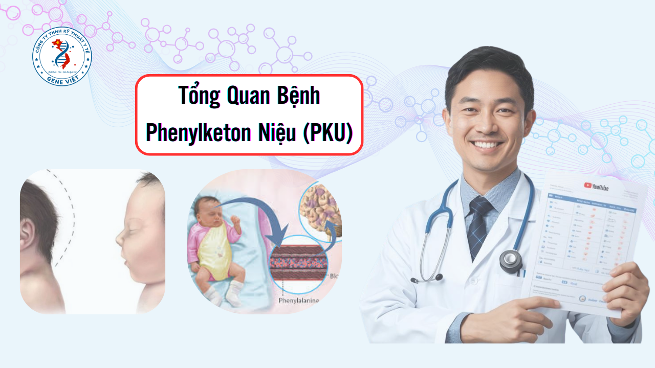 Tổng Quan Bệnh Phenylketon Niệu (PKU)
