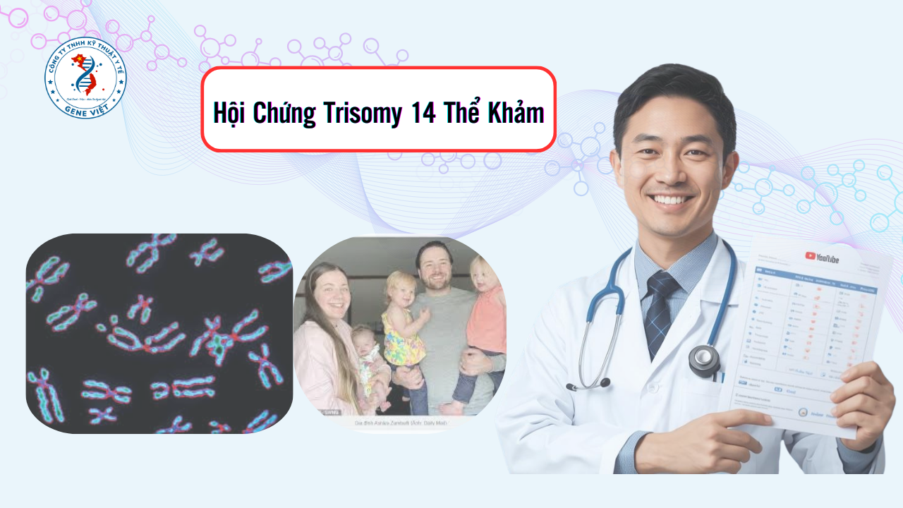 Hội Chứng Trisomy 14 Thể Khảm: Nguyên Nhân & Theo Dõi