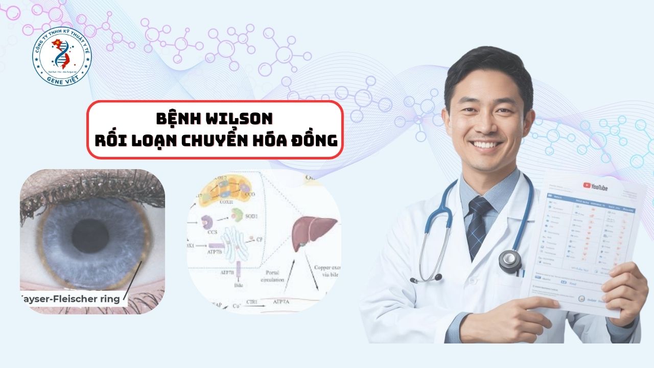 Bệnh Wilson -Rối Loạn Chuyển Hóa Đồng.