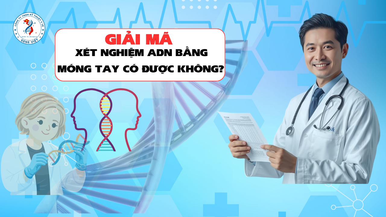 Xét Nghiệm ADN Bằng Móng Tay Có Được Không? Giải Đáp Những Điều Ít Người Biết