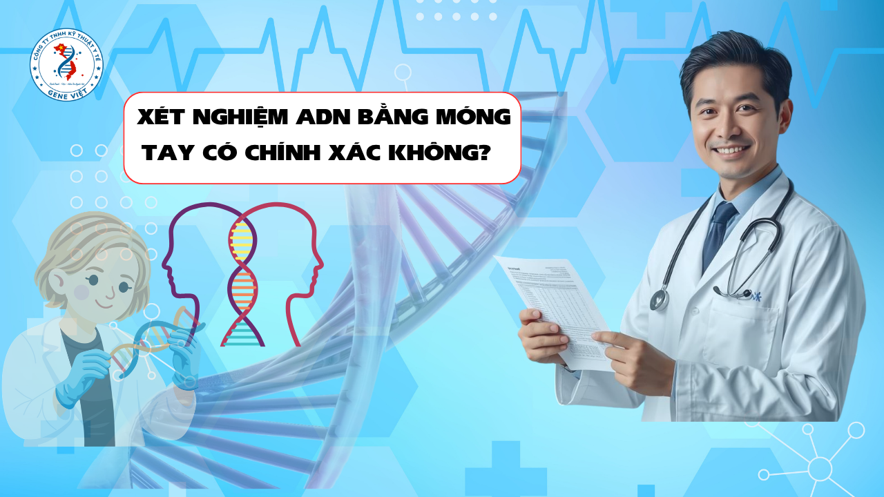 Xét Nghiệm ADN Bằng Móng Tay Có Chính Xác Không? Khi Nào Nên Sử Dụng?